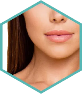 Hexagon crop of a woman's face and neck for Morpheus8 skin remodelling in London